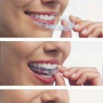 Is Invisalign Painful?